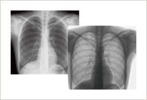 デジタル画像診断システム